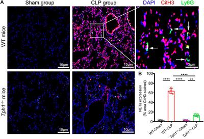 Activated Platelets Autocrine 5-Hydroxytryptophan Aggravates Sepsis-Induced Acute Lung Injury by Promoting Neutrophils Extracellular Traps Formation